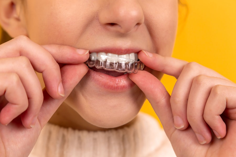 Dental Implants Turkey: Complete Guide for UK Patients 2026