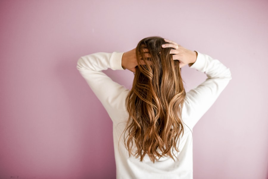 Hair Transplant Recovery Timeline: Week by Week Guide